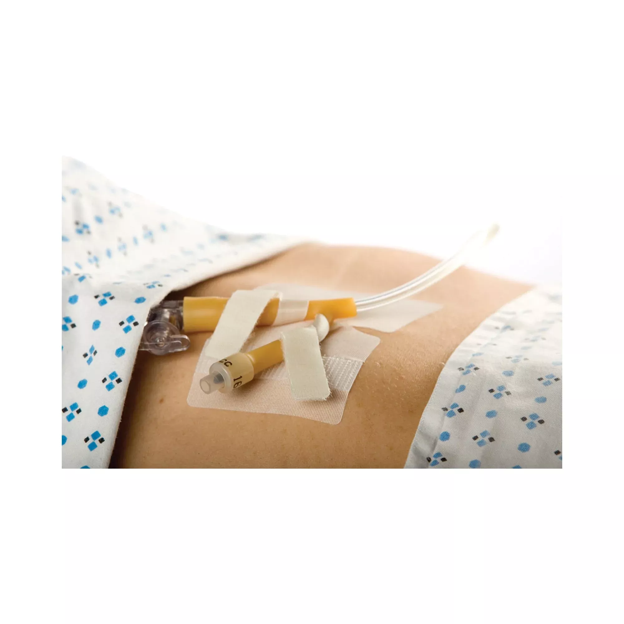 Cath-Secure Dual Tab Catheter Holder, 1 Each