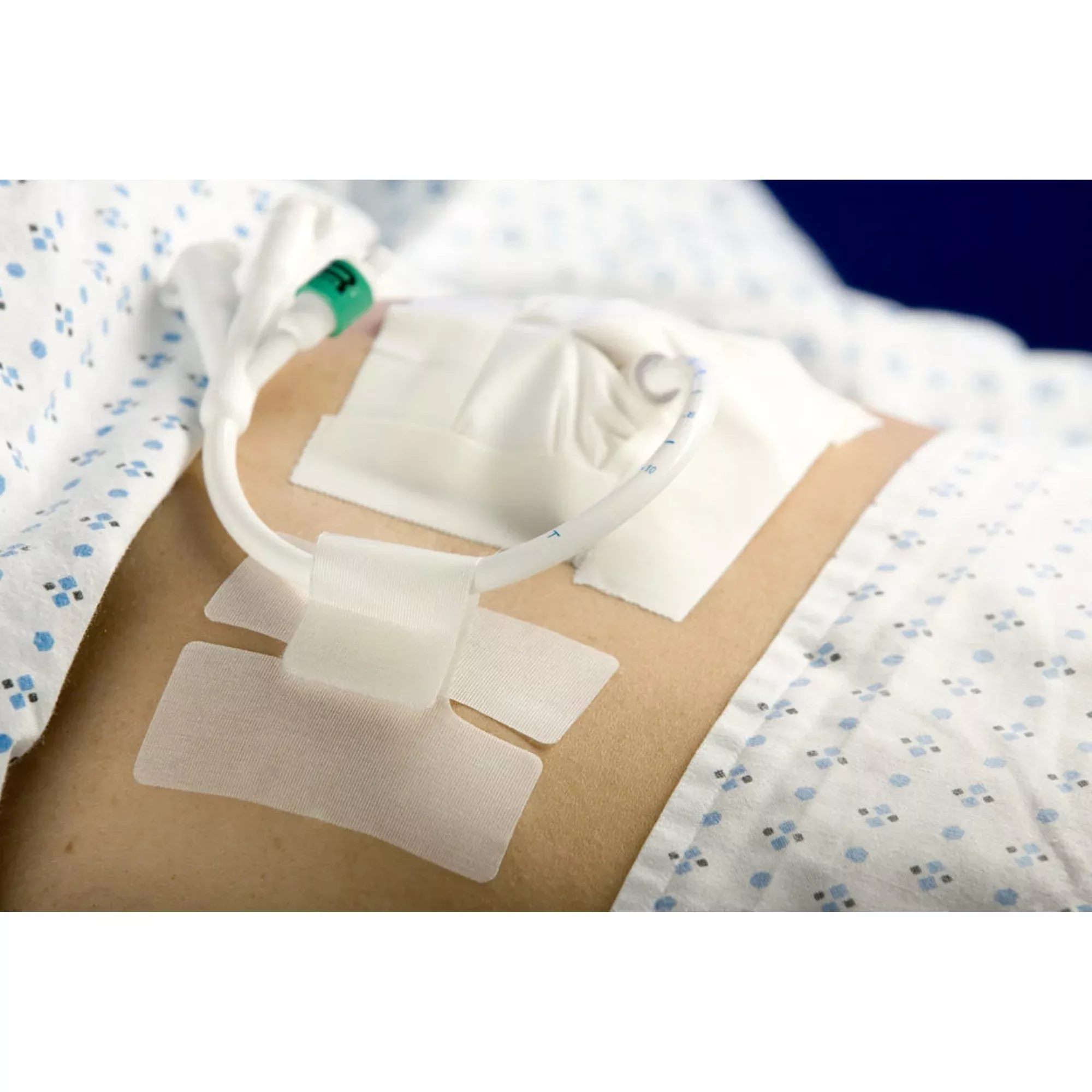 Cath-Secure™ Holder, Tube, 1 Box of 50