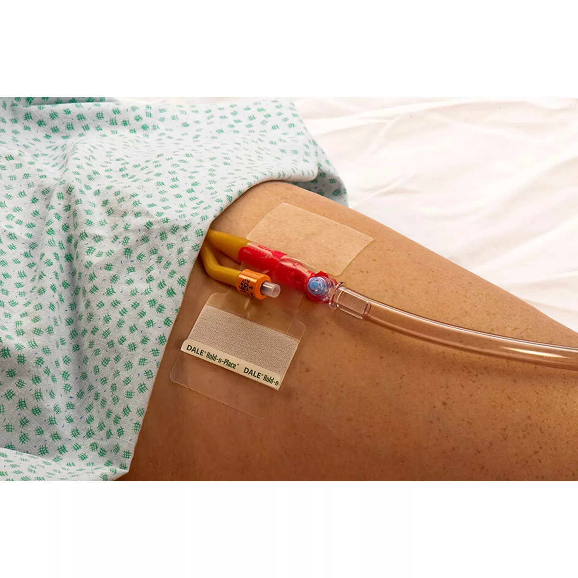 Dale Hold-n-Place Catheter Holder, 1 Each