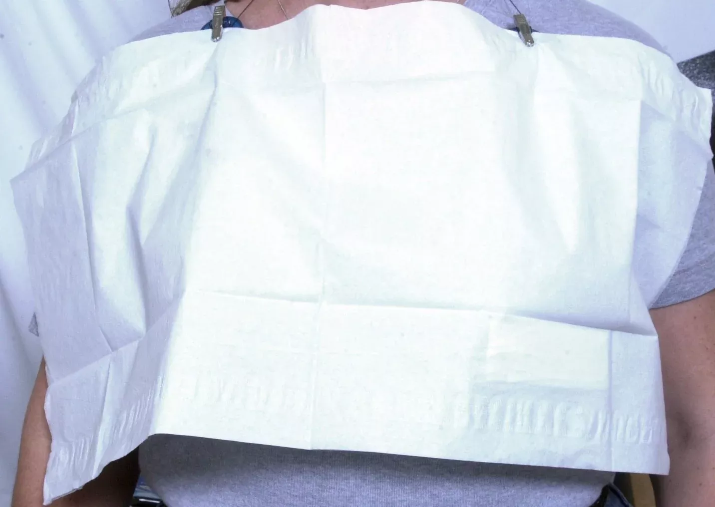 Graham Medical Sterile Breast General Purpose Drape, 12 x 24 Inch, 1 Case of 500