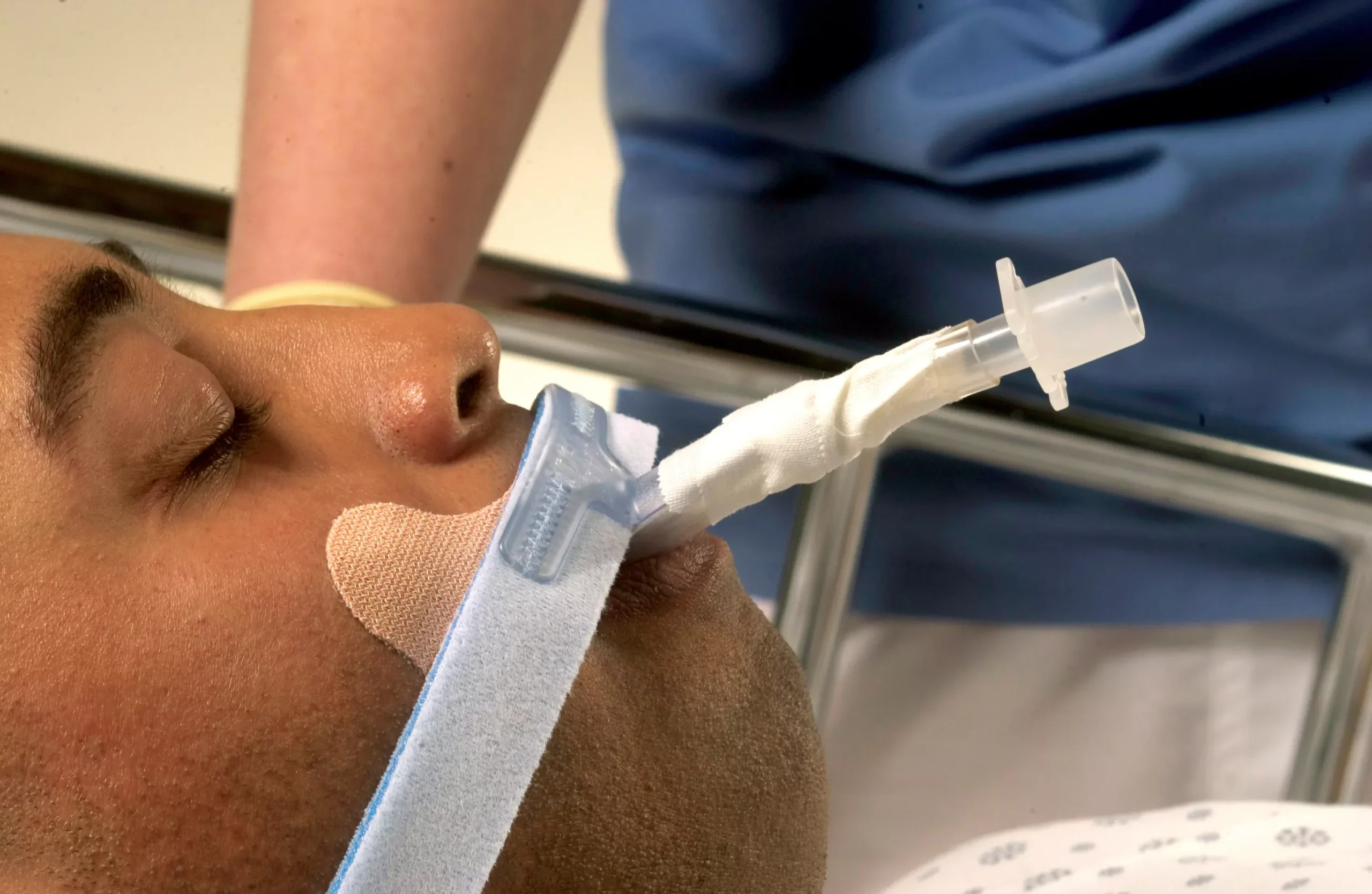 Stabilock™ Endotracheal Tube Holder, 1 Each