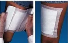White Adhesive Dressing, 6 x 6 Inch, 1 Case of 30